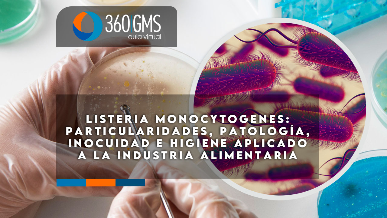 4401_C2 - Listeria Monocytogenes: Particularidades, Patología, Inocuidad e Higiene Aplicada a la Industria Alimentaria